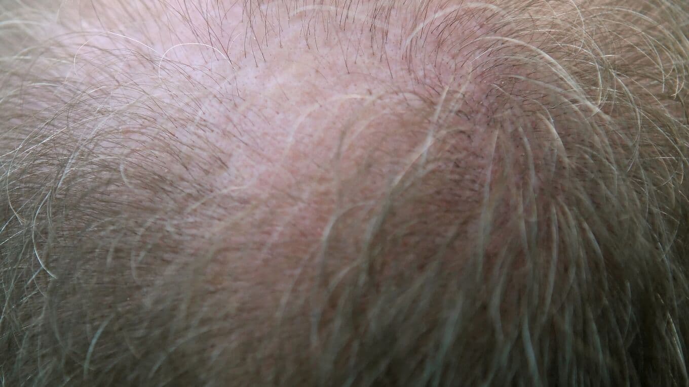 A closeup of a male head and hair